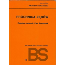Próchnica zębów