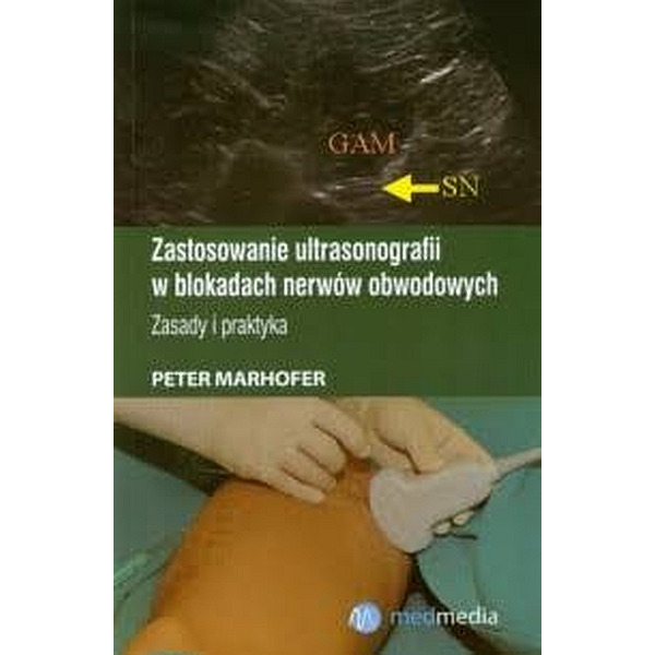 Zastosowanie ultrasonografii w blokadach nerwów obwodowych. Zasady i praktyka