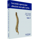 Leczenie operacyjne obrażeń narządu ruchu t.1