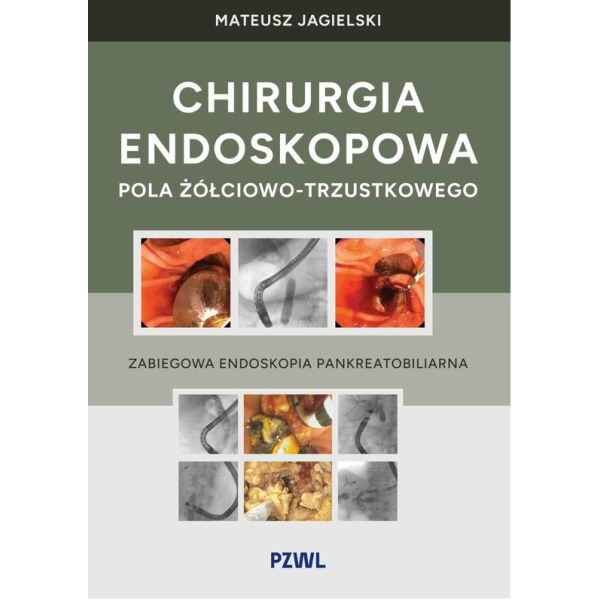 Chirurgia endoskopowa pola...