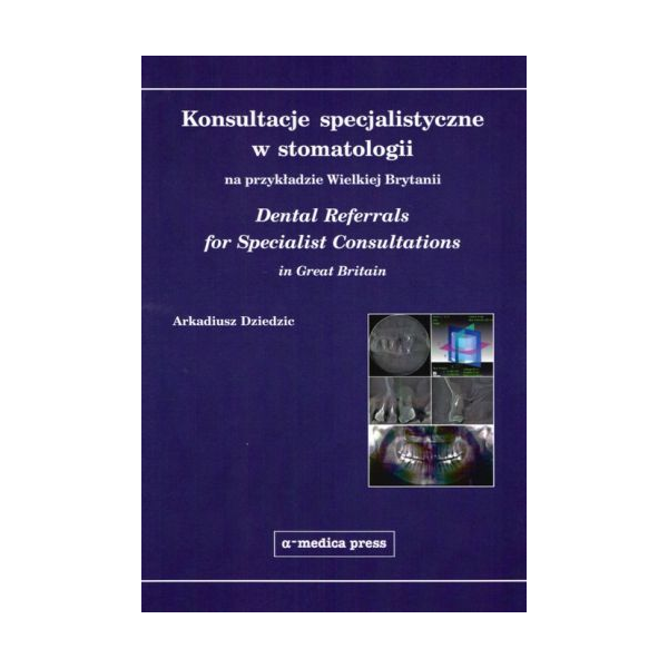 Konsultacje specjalistyczne w stomatologii na przykładzie Wielkiej Brytanii - Dental Referrals for Specialist Consultations in G