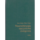 Neurochirurgia naczyniowa mózgowia