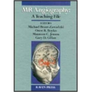 MR Angiography: A Teaching File Angiografia Przypadki do nauki