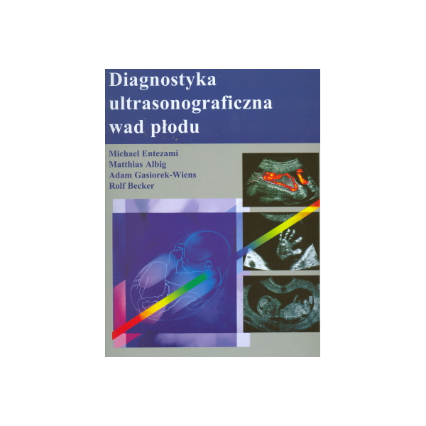 Diagnostyka ultrasonograficzna wad płodu