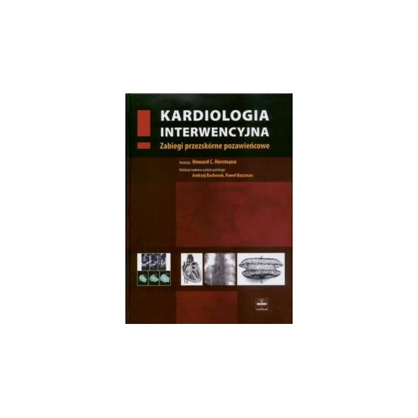 Kardiologia interwencyjna (z CD) Zabiegi przezskórne pozawieńcowe