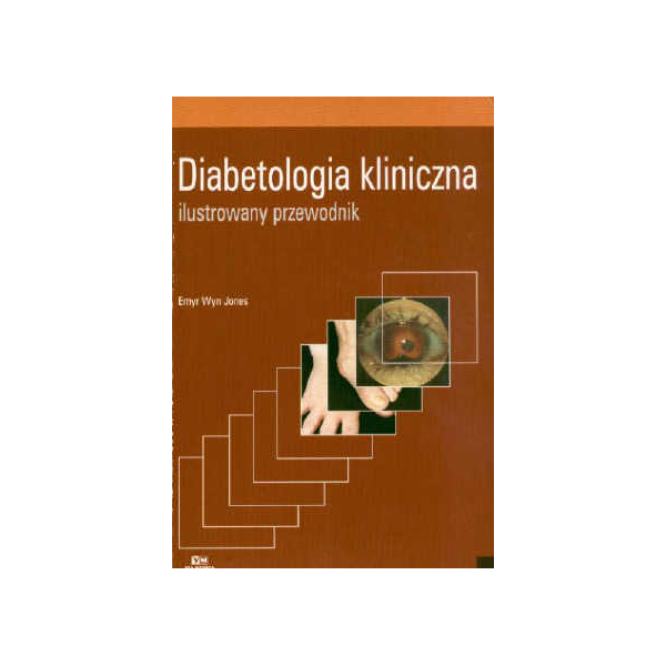 Diabetologia kliniczna Ilustrowany przewodnik