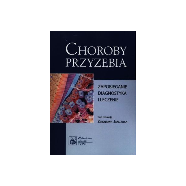 Choroby przyzębia
Zapobiegarnie diagnostyka i leczenie