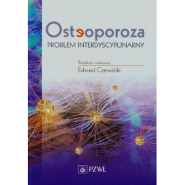 Osteoporoza Problem interdyscyplinarny