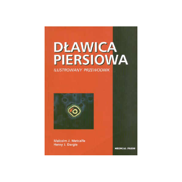 Dławica piersiowa Ilustrowany przewodnik