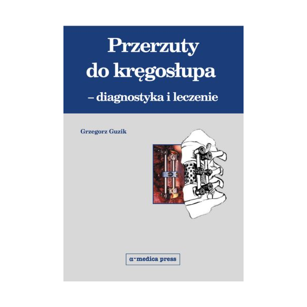 Przerzuty do kręgosłupa - diagnostyka i leczenie