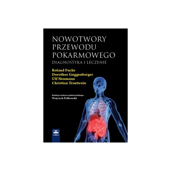 Nowotwory przewodu pokarmowego Diagnostyka i leczenie