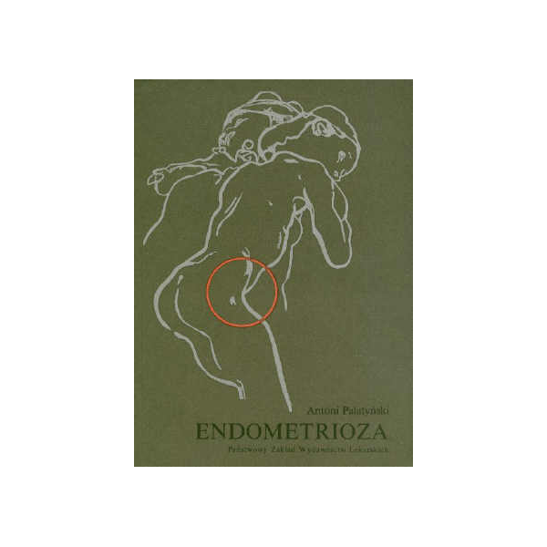 Endometrioza