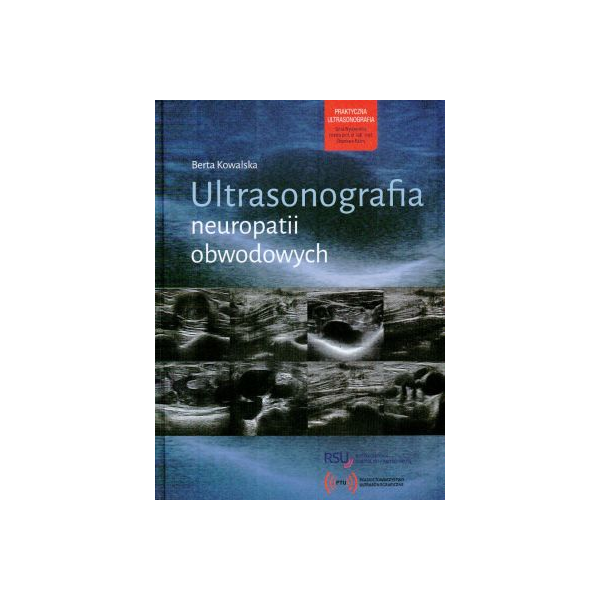 Ultrasonografia neuropatii obwodowych Ultrasonografia neuropatii obwodowych